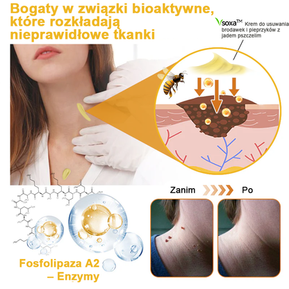 🌿🌿Krem FROPUN™ do usuwania brodawek i znamion z jadem pszczelim🔥(Ostatni dzień promocji 80% zniżki）