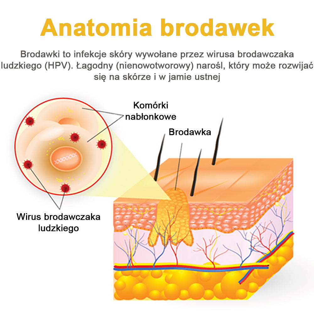 🌿🌿Krem FROPUN™ do usuwania brodawek i znamion z jadem pszczelim🔥(Ostatni dzień promocji 80% zniżki）