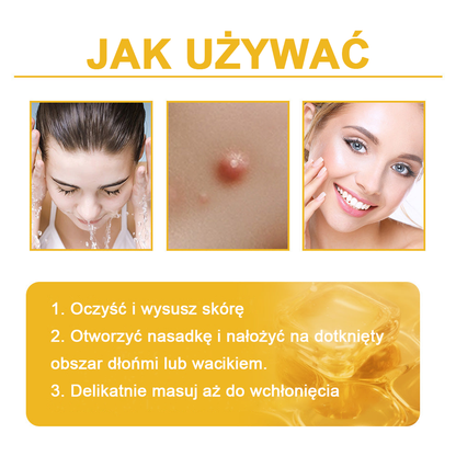 🌿🌿Krem FROPUN™ do usuwania brodawek i znamion z jadem pszczelim🔥(Ostatni dzień promocji 80% zniżki）