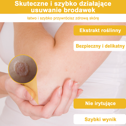 🌿🌿Krem FROPUN™ do usuwania brodawek i znamion z jadem pszczelim🔥(Ostatni dzień promocji 80% zniżki）