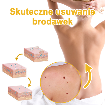 🌿🌿Krem FROPUN™ do usuwania brodawek i znamion z jadem pszczelim🔥(Ostatni dzień promocji 80% zniżki）