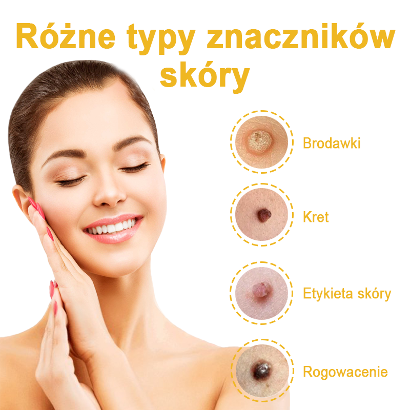 🌿🌿Krem FROPUN™ do usuwania brodawek i znamion z jadem pszczelim🔥(Ostatni dzień promocji 80% zniżki）