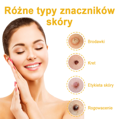 🌿🌿Krem FROPUN™ do usuwania brodawek i znamion z jadem pszczelim🔥(Ostatni dzień promocji 80% zniżki）