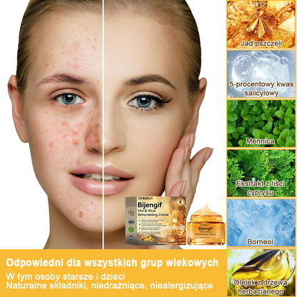 🌿🌿Krem FROPUN™ do usuwania brodawek i znamion z jadem pszczelim🔥(Ostatni dzień promocji 80% zniżki）