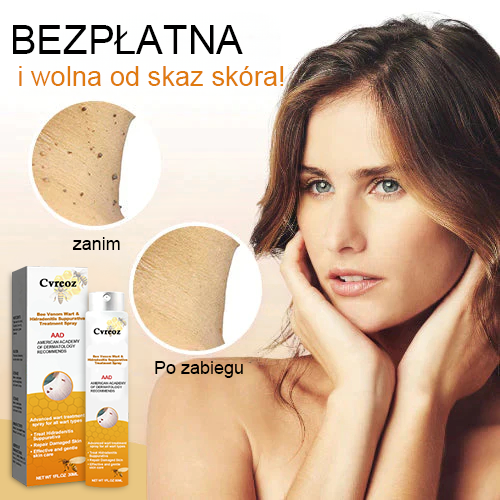 💎Cvreoz spray do usuwania brodawek i pieprzyków z jadem pszczelim (👨‍⚕OFERTA DDG)🐝🐝(🔥oferta ostatniego dnia z 80% rabatem)