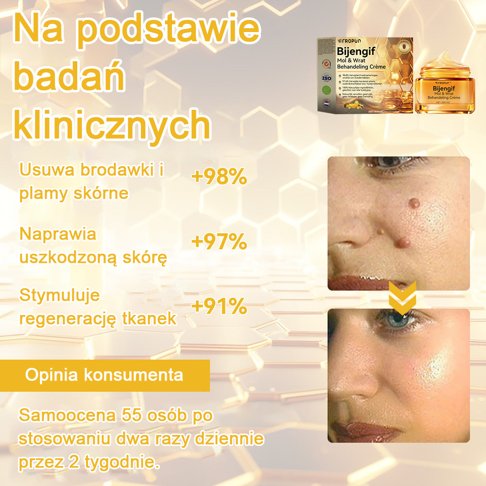 🌿🌿Krem FROPUN™ do usuwania brodawek i znamion z jadem pszczelim🔥(Ostatni dzień promocji 80% zniżki）